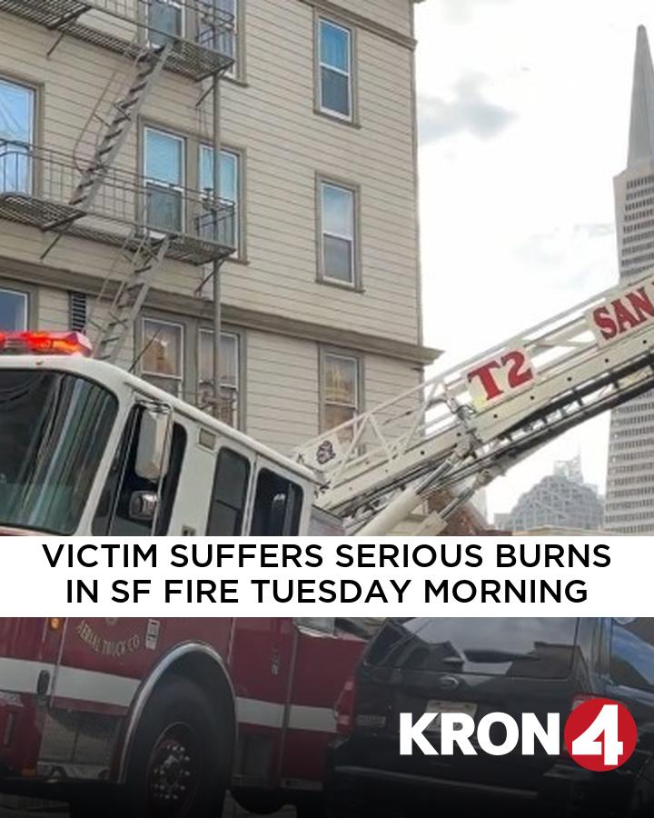 Victim suffers serious burns in one-alarm fire in SF Tuesday morning